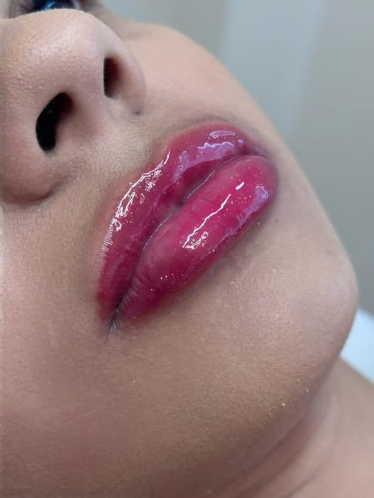 Lábios hidratados, com contorno realçado e cor após o Hydra Color